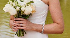 Wedding Ring Metals and Skin Allergies: How to Avoid Them
